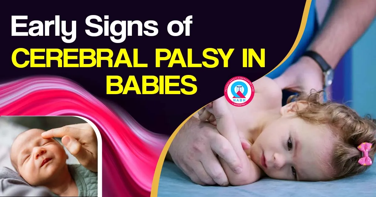 early-signs-of-cerebral-palsy-in-babies